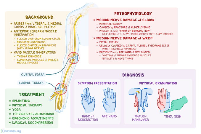 Symptoms of median nerve problems - MEDizzy