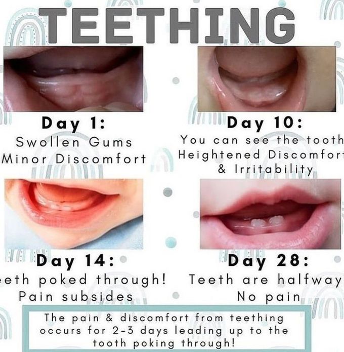 Teething