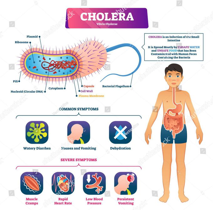 Cholera