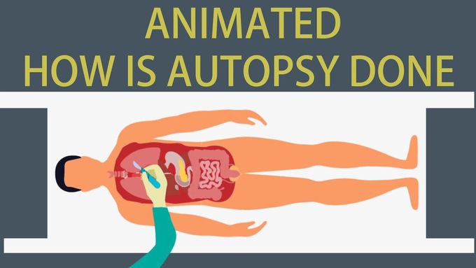 How is Autopsy done?