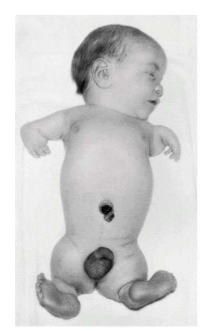 What is your diagnosis？