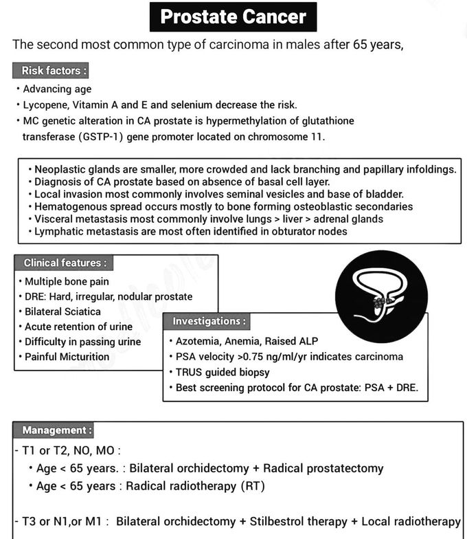 Prostate cancer