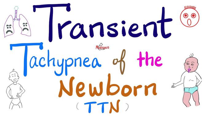 Transient Tachypnea of the Newborn (TTN) | Pediatrics