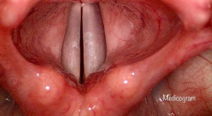 These are vocal cords, and they look just awesome! 