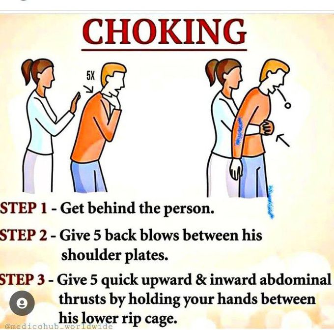 First-aid for choking