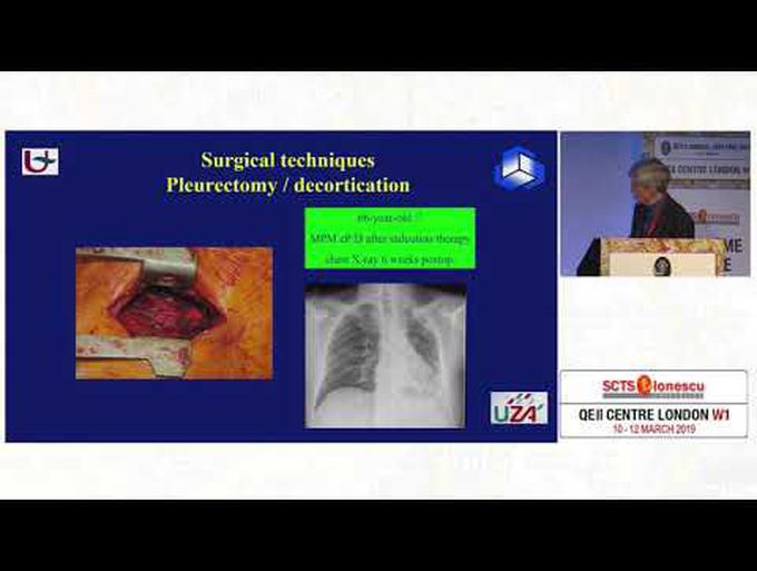 Current Status of the Management of Mesothelioma