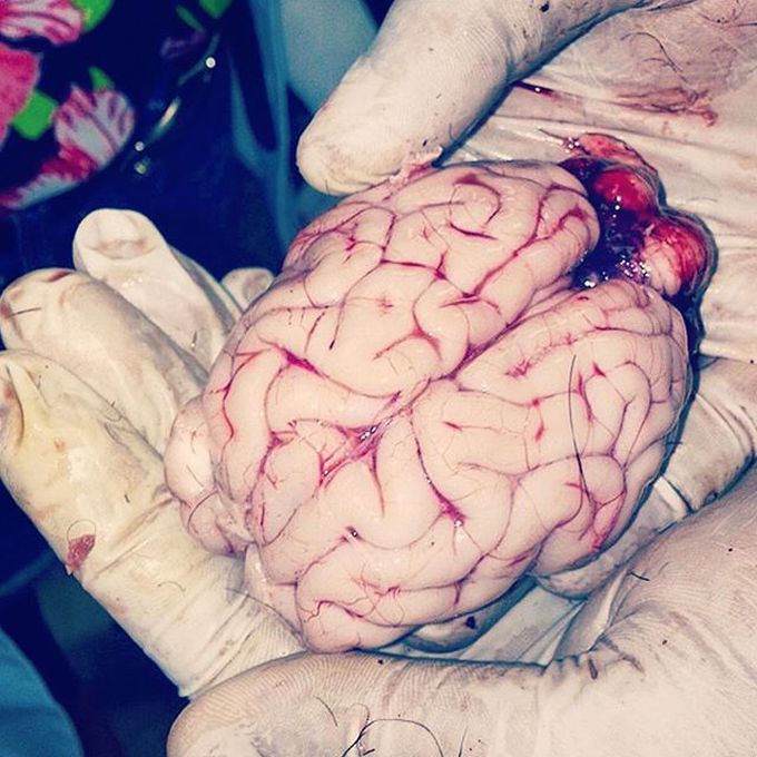 Brain of an infant