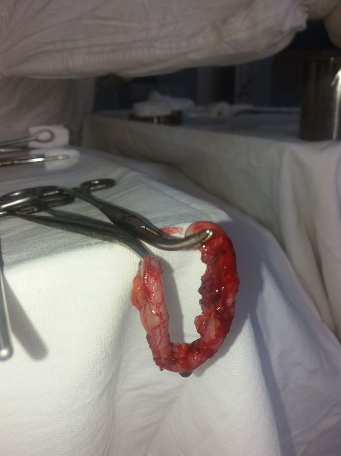 Appendix