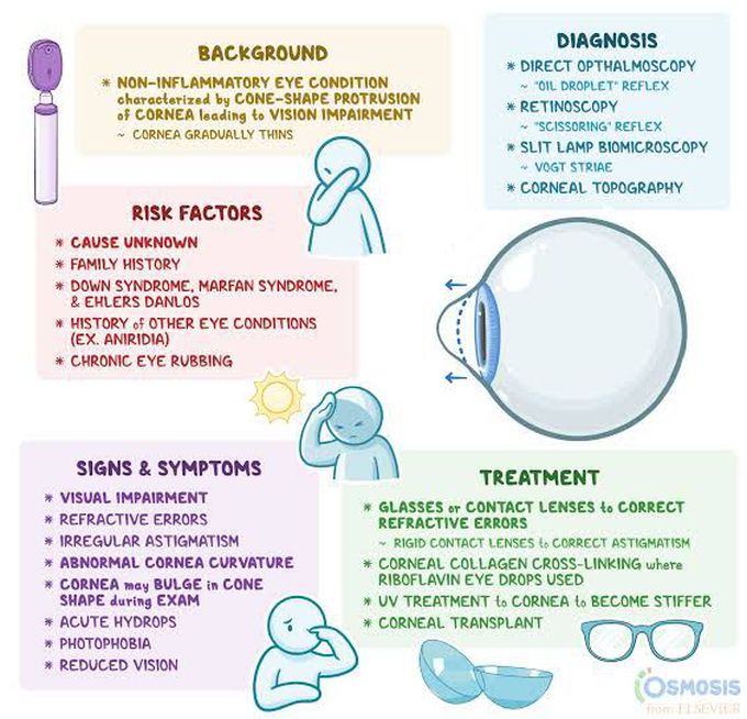 Keratoconus symptoms