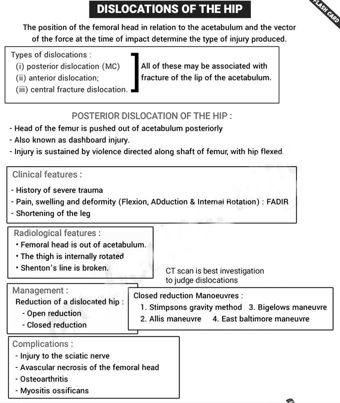 Dislocation of hip