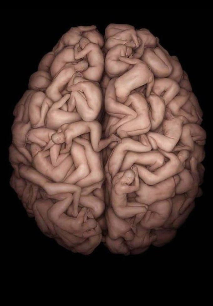 Brain ART