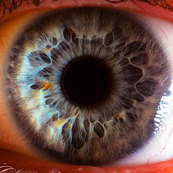 Eyeball