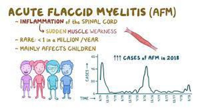 What is the treatment for acute flaccid myelitis?