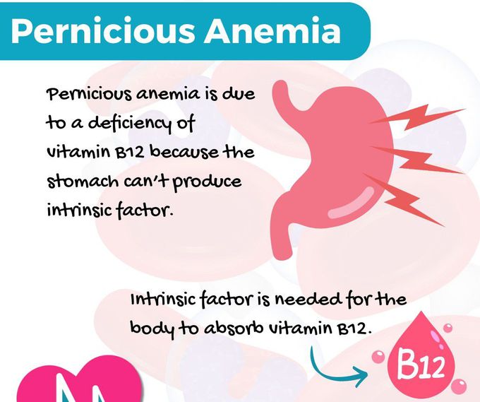 Pernicious Anemia