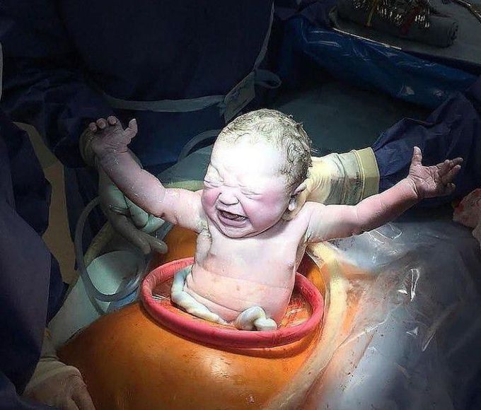 Birth via C-section