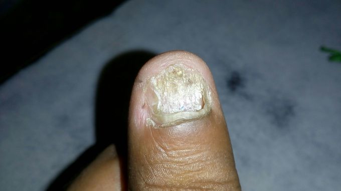 What is this please describe.any solution .some medicine.
