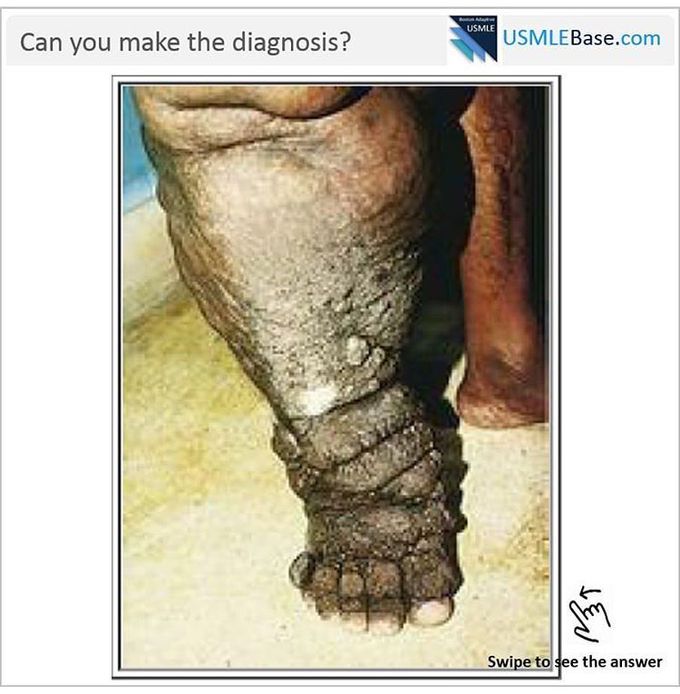 Can you make a diagnosis?