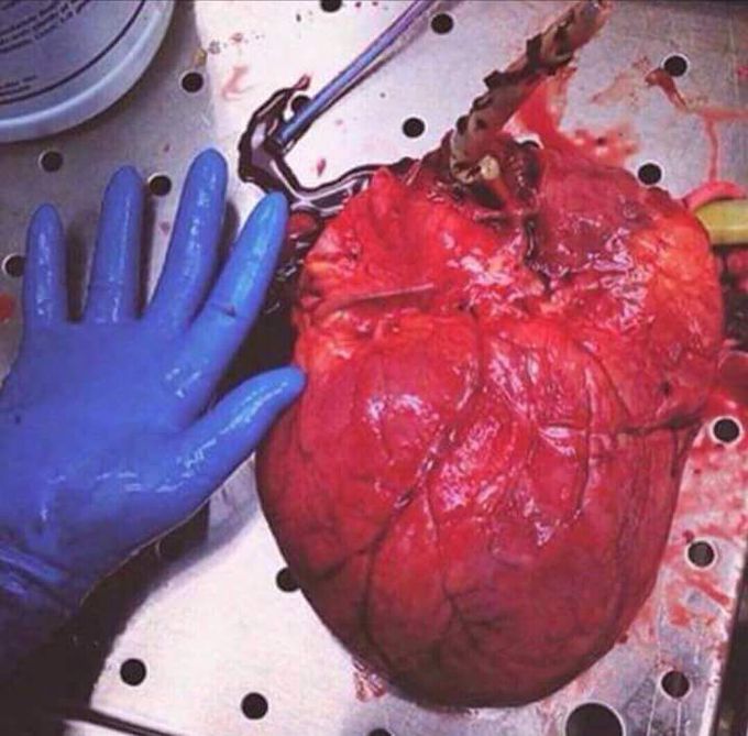 Heart