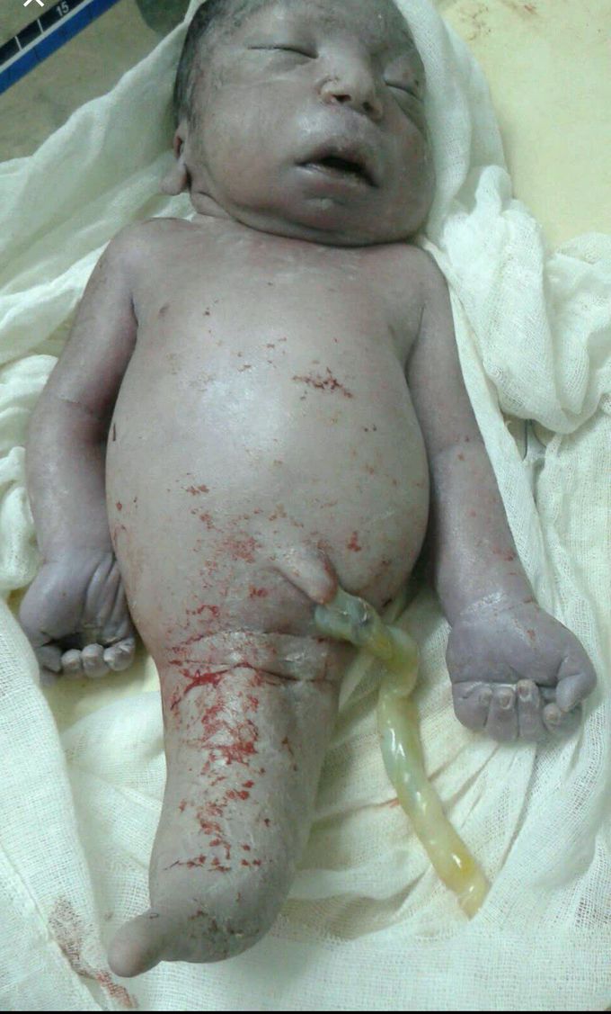 What is this condition called?