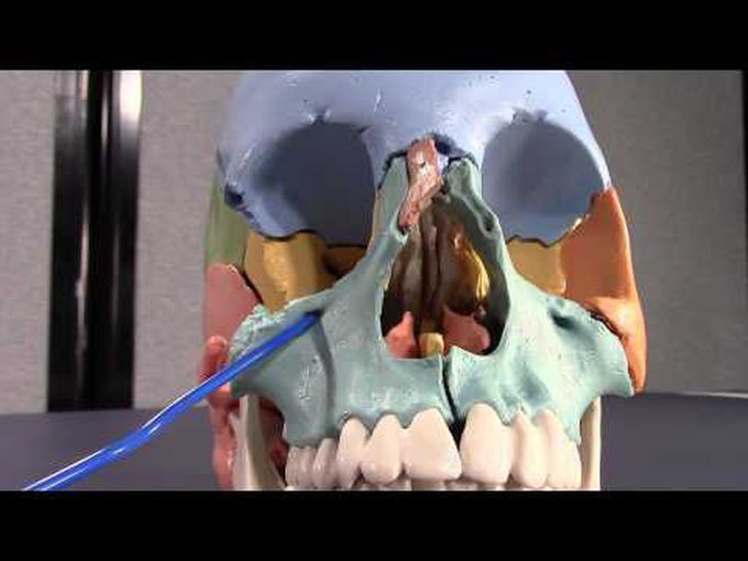 Maxilla and Zygoma: Osteology