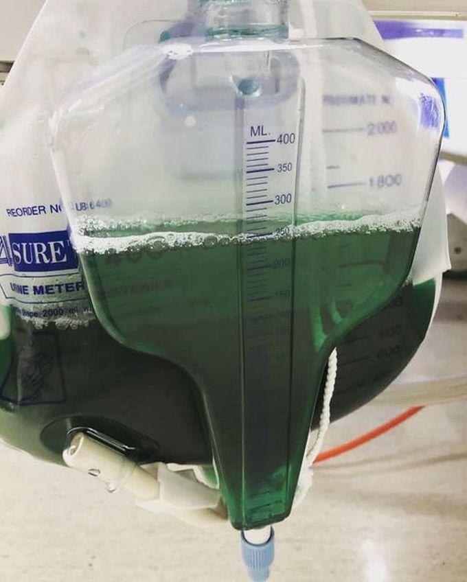 Green Urine: An Interesting Rare Case