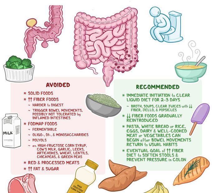 Treatment for Diverticulitis