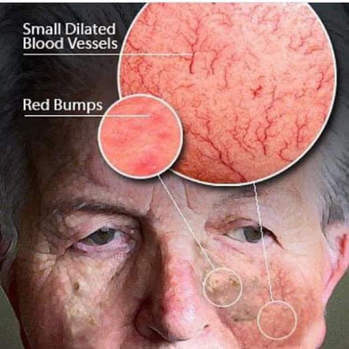 Diagnosis ??