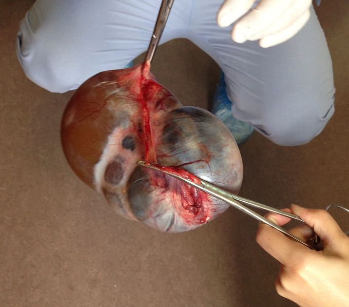 What's the diagnosis?
