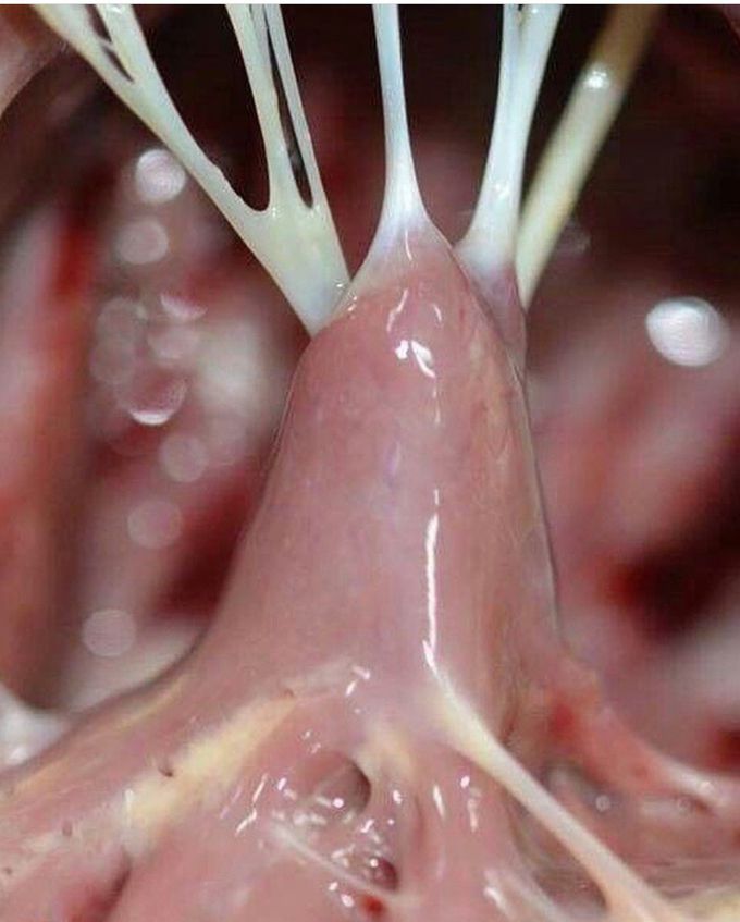 The Magnificent Chordae Tendineae