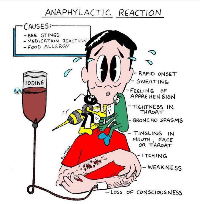 Anaphylactic reaction - MEDizzy