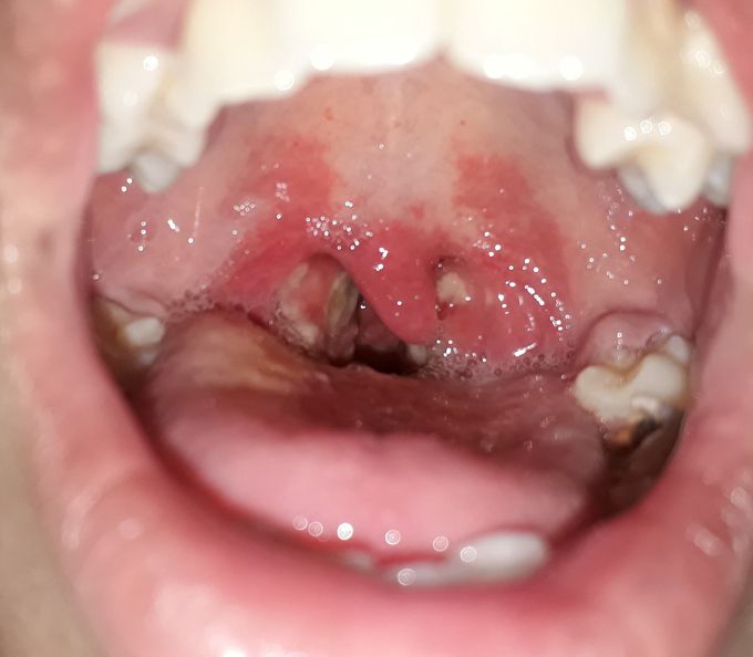 ENT case