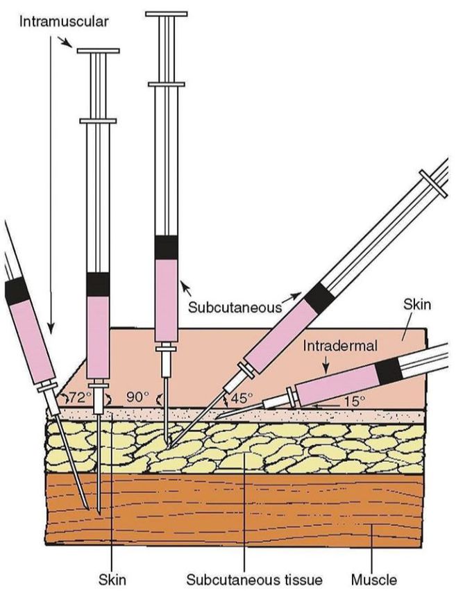 Types of injections - MEDizzy