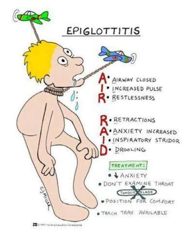 Epiglottitis