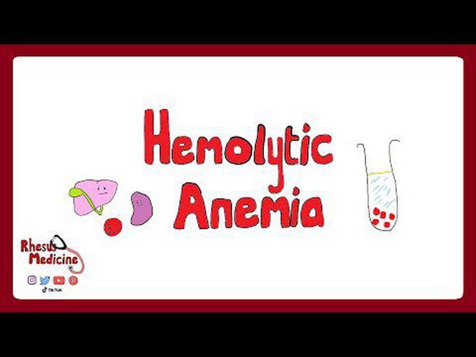 Short review of Hemolytic Anemia