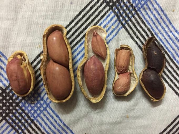 ObGy teaching his residents in most simply way 

obstetrician_eating_peanuts