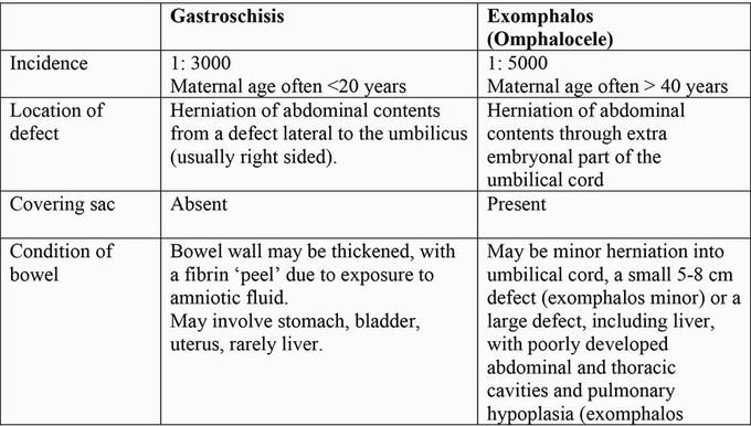 Gastroschisis vs Omphalocele