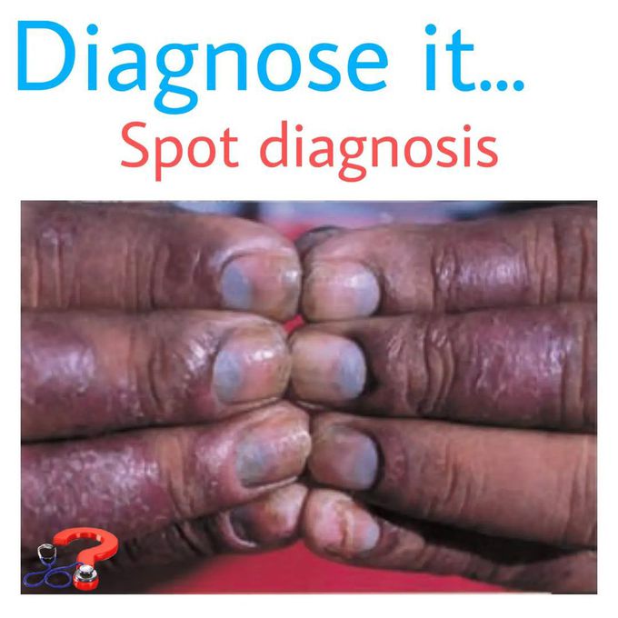 Diagnose it