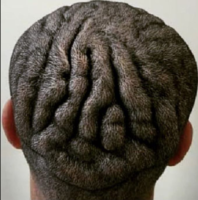 What is the name of this condition??