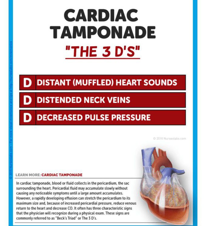 Tips for cardiac tamponade traid