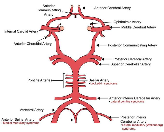 Circle of Willis