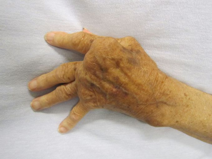 What's your diagnosis ?!!