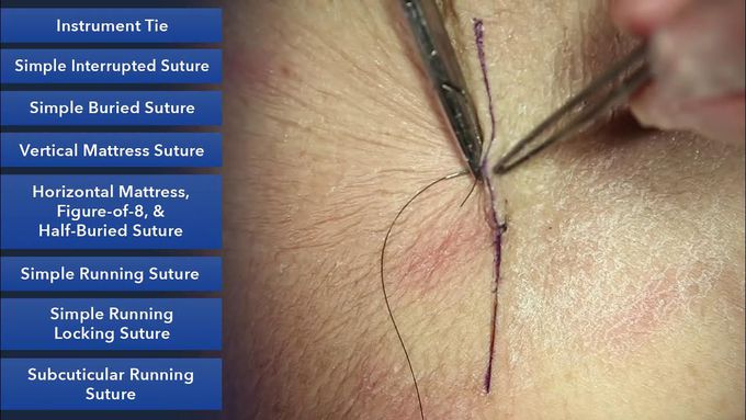 Learn How To Suture - Best Suture Techniques
