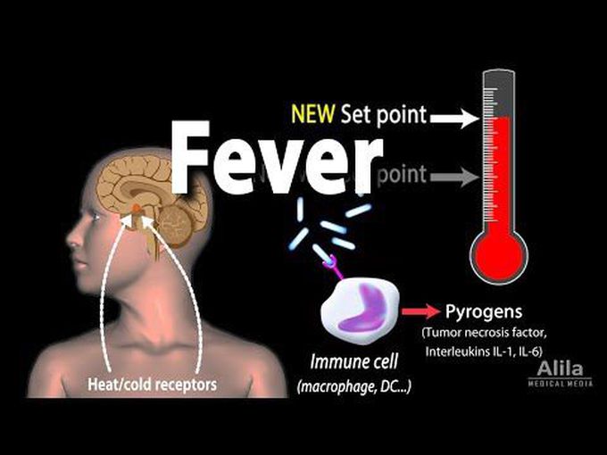 Fever and Hyperthermia