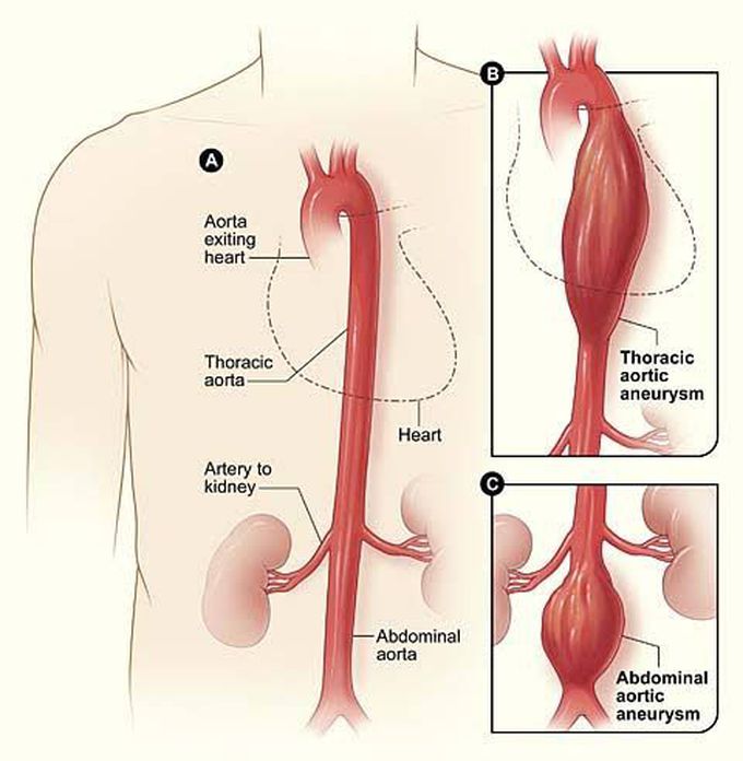 Thoracic aorta
