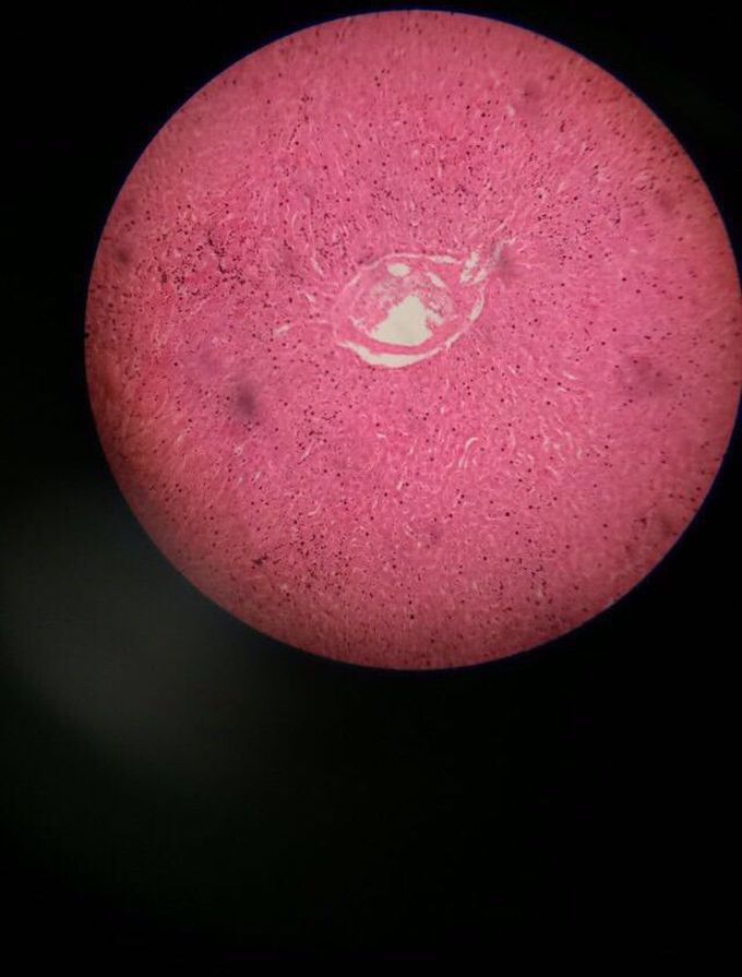 Slide identification:Liver