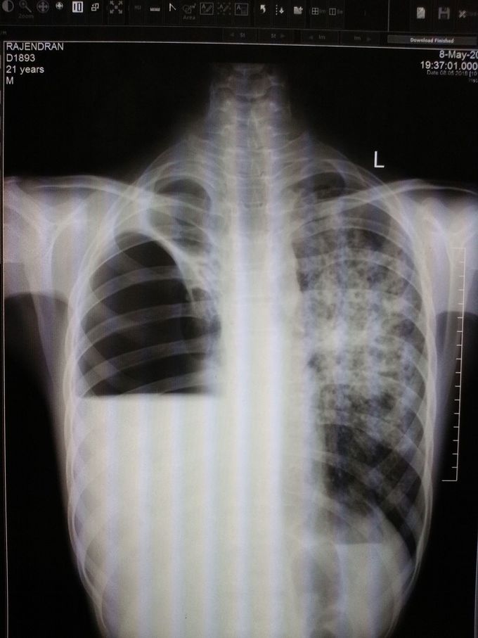 What is your diagnosis