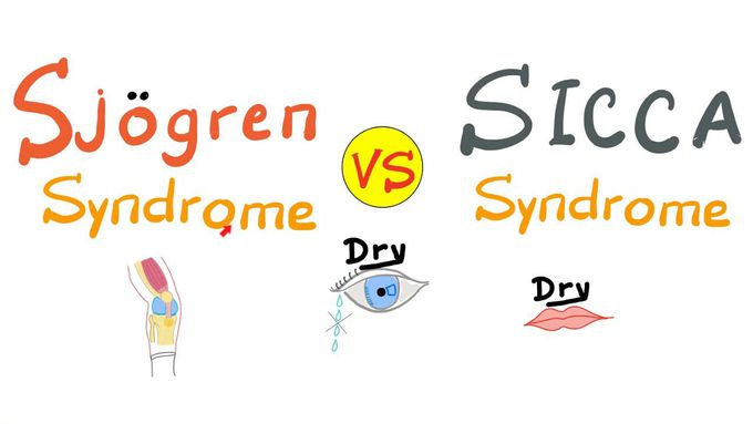 Sjögren Syndrome Vs Sicca Syndrome