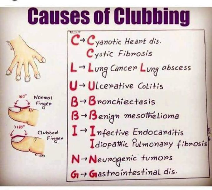 Causes of clubbing