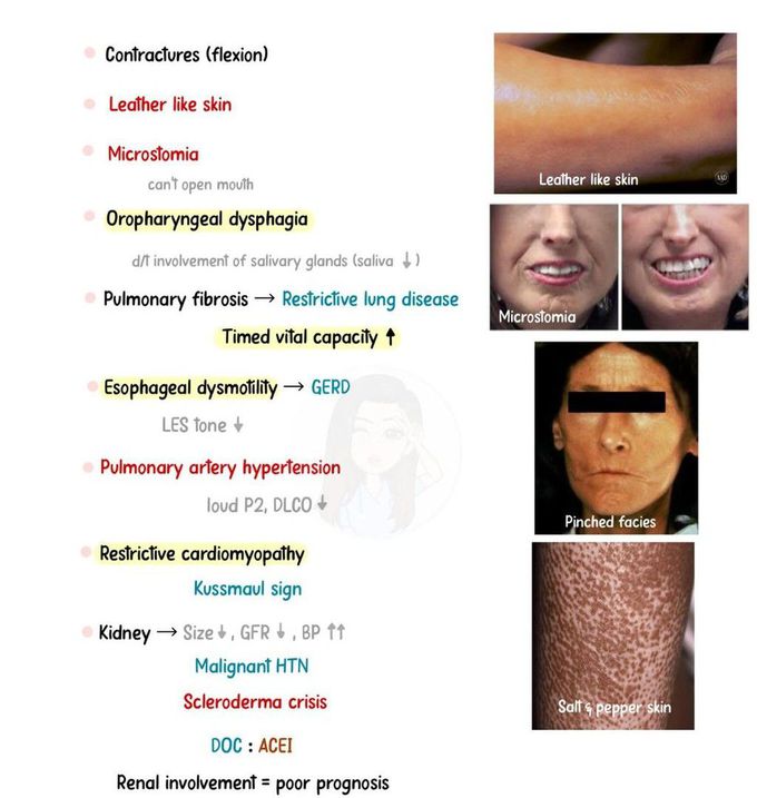 Scleroderma II