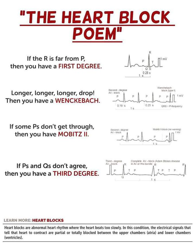 What is heart block